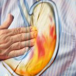 10 Home Remedies for Heartburn and Acid Reflux