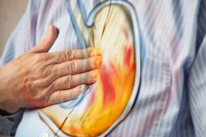 10 Home Remedies for Heartburn and Acid Reflux